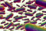 E.coli, E.coli Outbreak breaking, all about e coli outbreak in the united kingdom, E coli outbreak