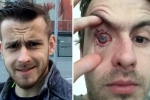 lens in shower, contact lens in shower, contact lens wearers beware man goes blind after parasites eat man s eye as he wore lenses in shower, Eyesight