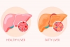 How to Reverse Grade 2 Fatty Liver?