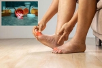 Gout Drugs vs Heart attack, Gout Drugs news, gout drugs may cut the risk of heart attack, Relationship Gout Drugs vs Heart attack, Gout Drugs news, gout drugs may cut the risk of heart attack, Relationship