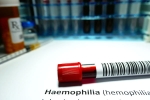 Hemophilia health tips, Hemophilia, why are men likely to develop hemophilia, Fusion