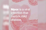mpox news, who on mpox, mpox emergency again, Tamil nadu government
